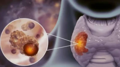 9 sinais de alerta da tireoide que exigem atenção imediata 2 9 sinais de alerta da tireoide que exigem atenção imediata