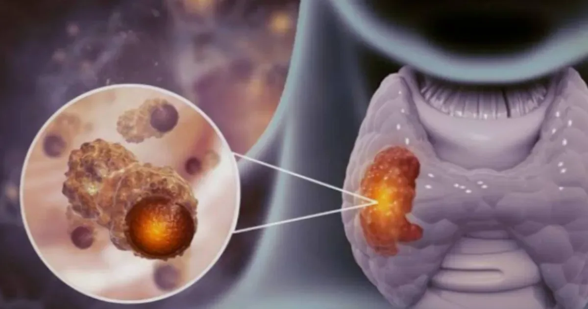 9 sinais de alerta da tireoide que exigem atenção imediata 1 9 sinais de alerta da tireoide que exigem atenção imediata