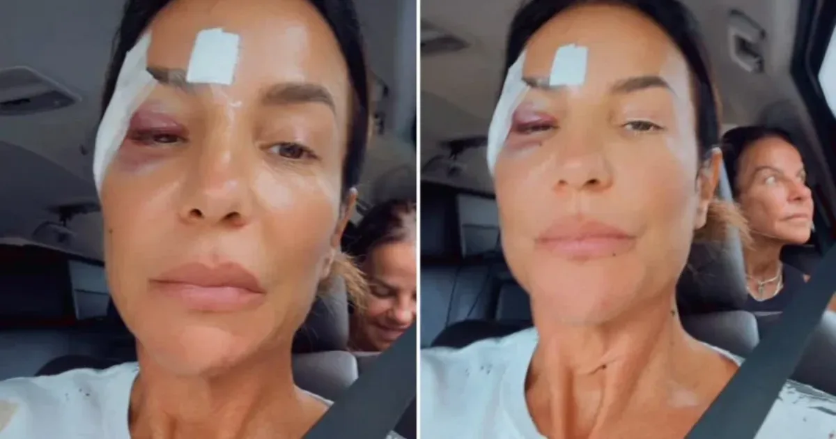 Alta Médica: Ivete Sangalo deixa hospital após susto e revela diagnóstico real