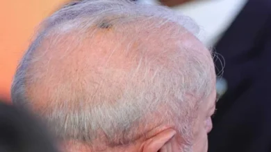 artigo 83ae96675fec639d2b854a72