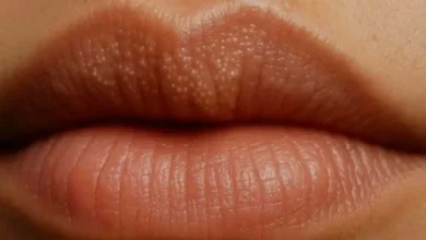 Bolinhas nos lábios: entenda o que são e como tratar