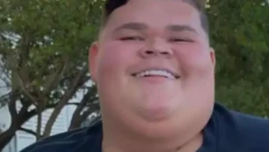 Gordão da XJ passa por cirurgia após perder mais de 130 kg