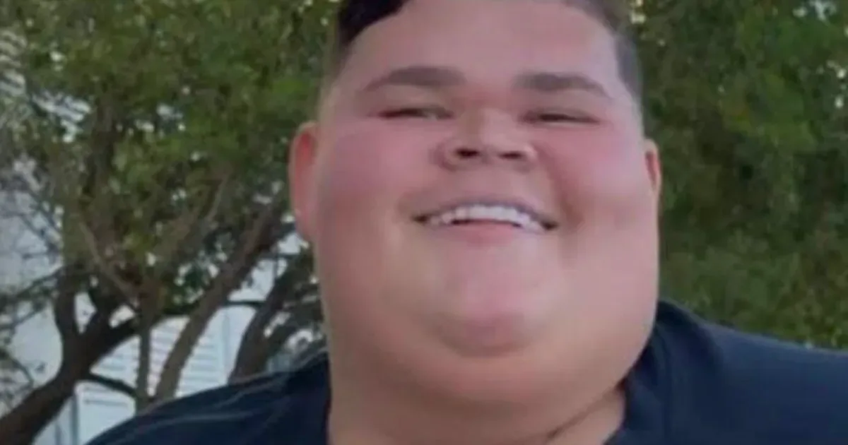 Gordão da XJ passa por cirurgia após perder mais de 130 kg