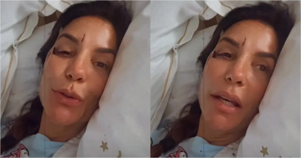 Ivete Sangalo precisou ser levada para o hospital às pressas após acidente 1 Ivete Sangalo precisou ser levada para o hospital às pressas após acidente