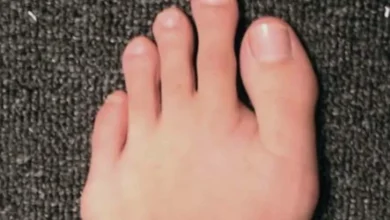 Pé grego: a história e os mistérios do segundo dedo mais longo