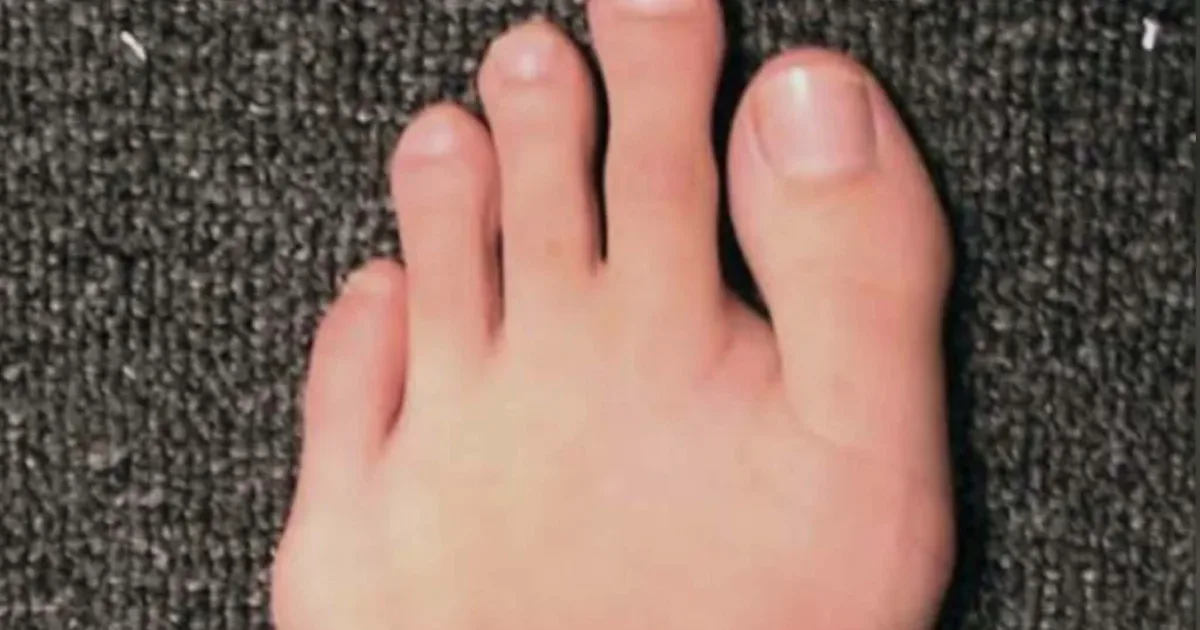 Pé grego: a história e os mistérios do segundo dedo mais longo 1 Pé grego: a história e os mistérios do segundo dedo mais longo