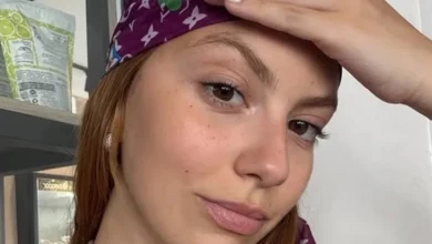 Tratando câncer aos 24, neta de Carlos Alberto relata efeito colateral 3 Tratando câncer aos 24, neta de Carlos Alberto relata efeito colateral