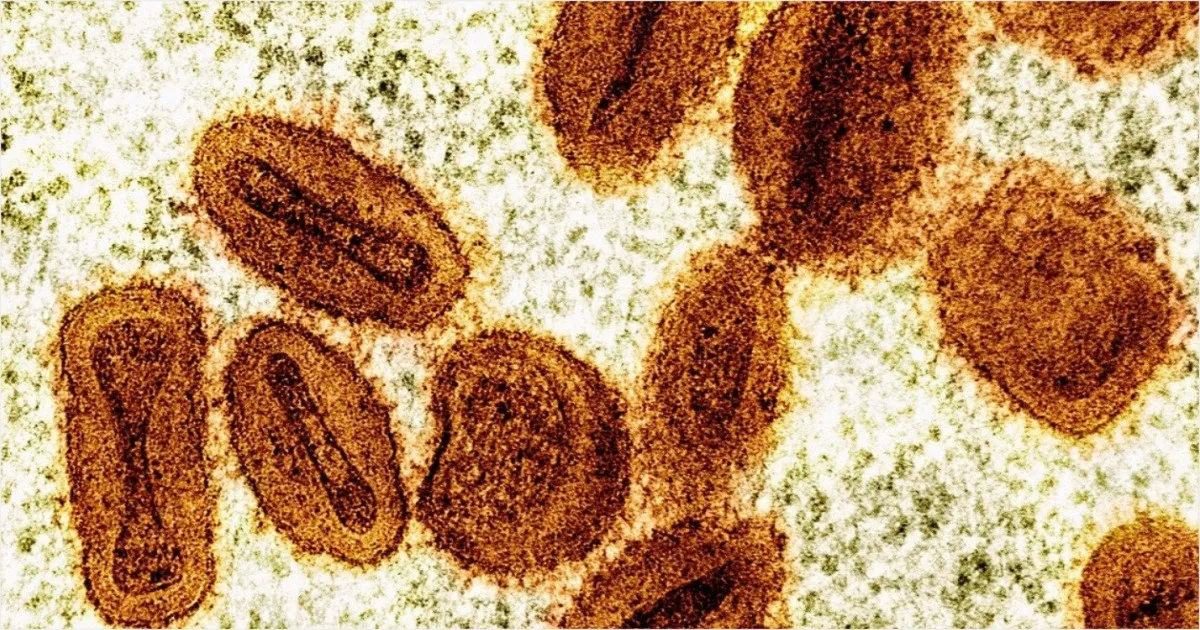 Vários casos da Mpox estão sendo confirmados no Brasil e autoridades ficam em alerta