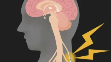 Ativar o nervo vago: por que o tema se tornou a nova febre do bem-estar