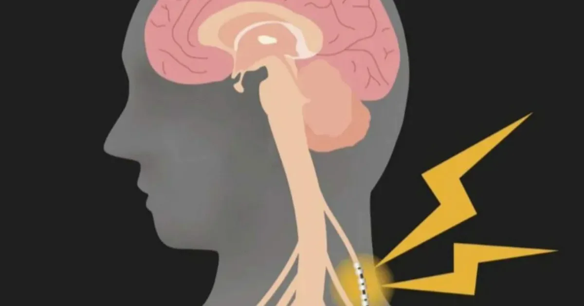 Ativar o nervo vago: por que o tema se tornou a nova febre do bem-estar