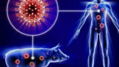 Autoridades espanholas notificam OMS após caso suspeito de gripe suína 3 Autoridades espanholas notificam OMS após caso suspeito de gripe suína