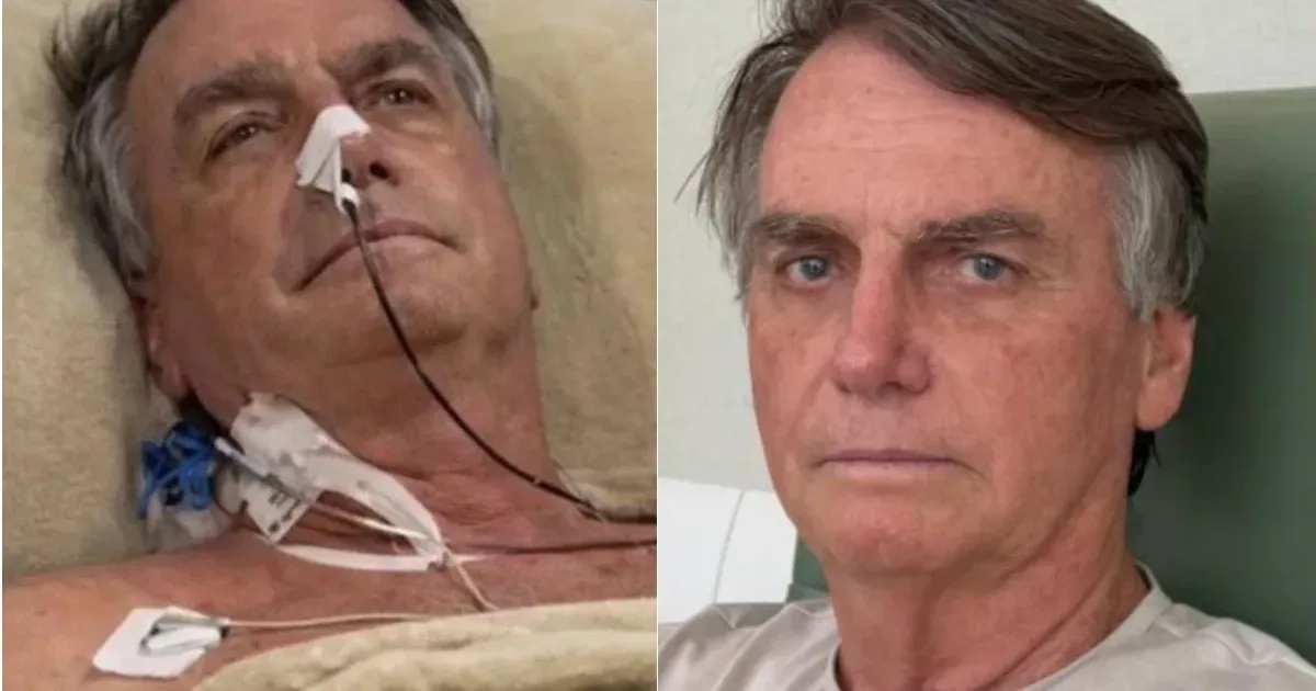 Chega última atualização sobre o estado de saúde de Bolsonaro na UTI