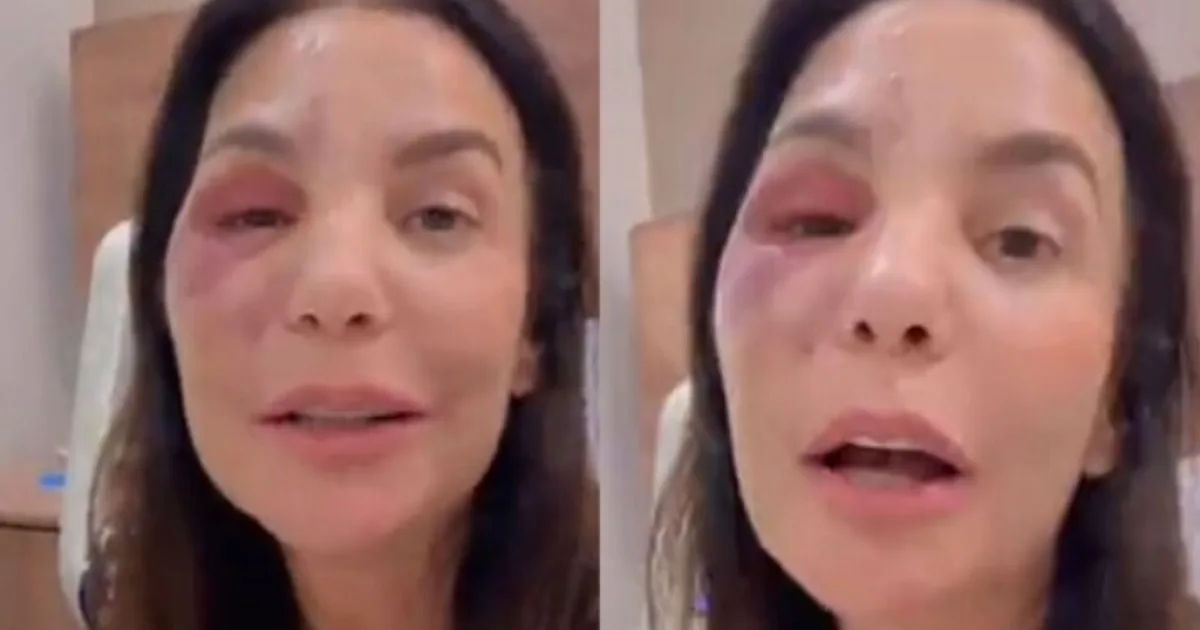 Depois de dois dias em hospital, Ivete Sangalo vem a público; entenda