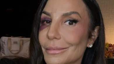 Pesquisador suspeita que olho roxo de Ivete Sangalo seja seita 2 Pesquisador suspeita que olho roxo de Ivete Sangalo seja seita